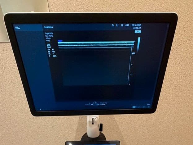 Echographe Samsung HS40 3